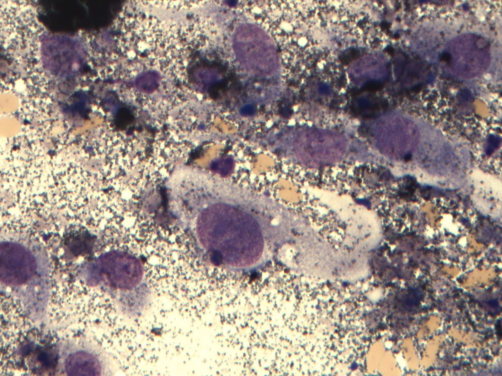 Cutaneous malignant melanoma in a rabbit Case Study Cytopath