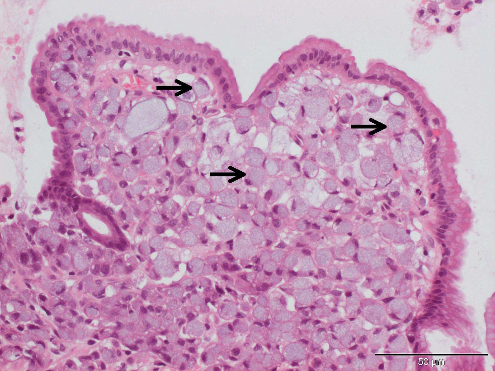cell carcinoma in the stomach of a dog Case Study Cytopath