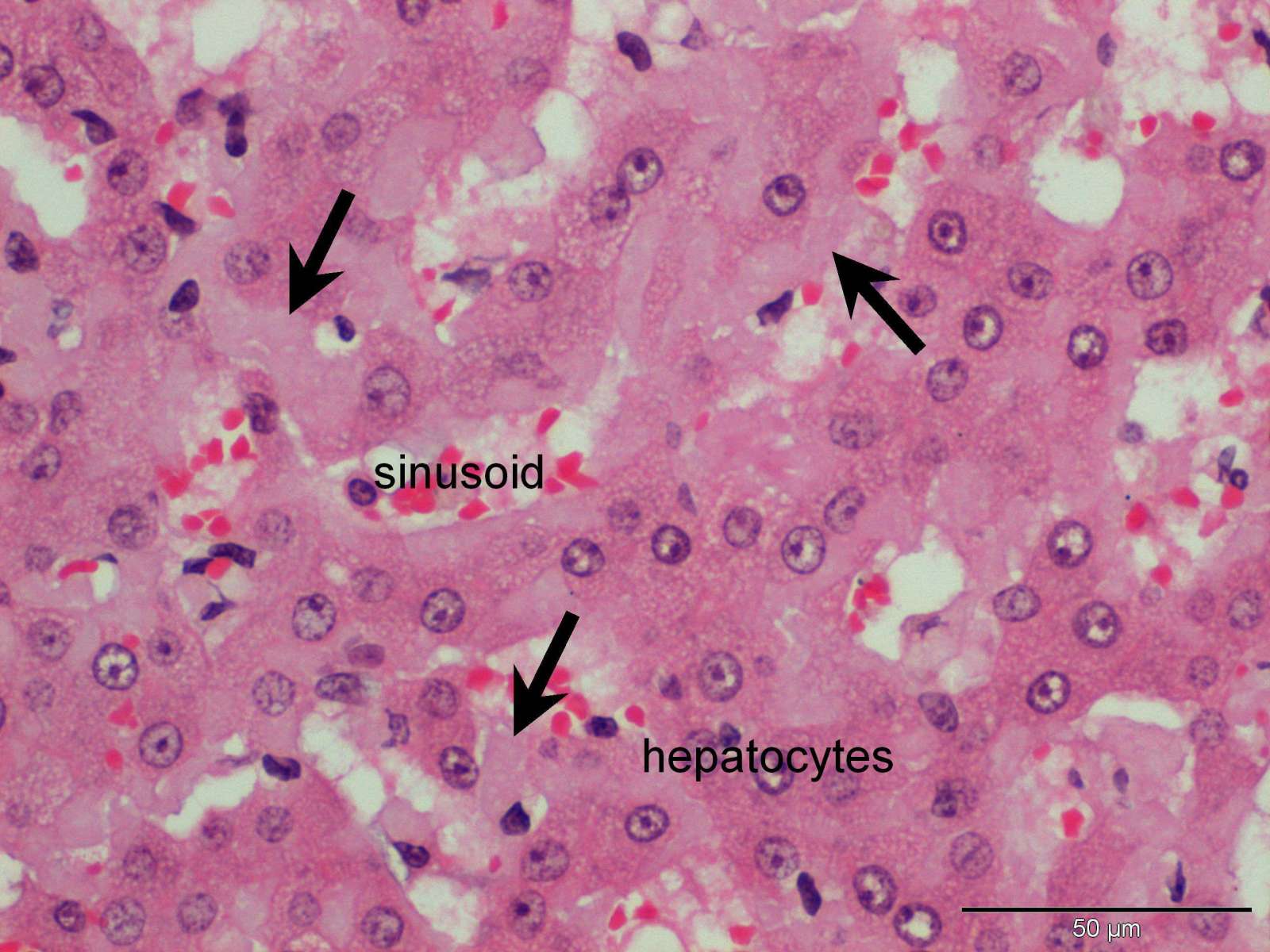 Hepatic amyloidosis in a cat Case Study Cytopath