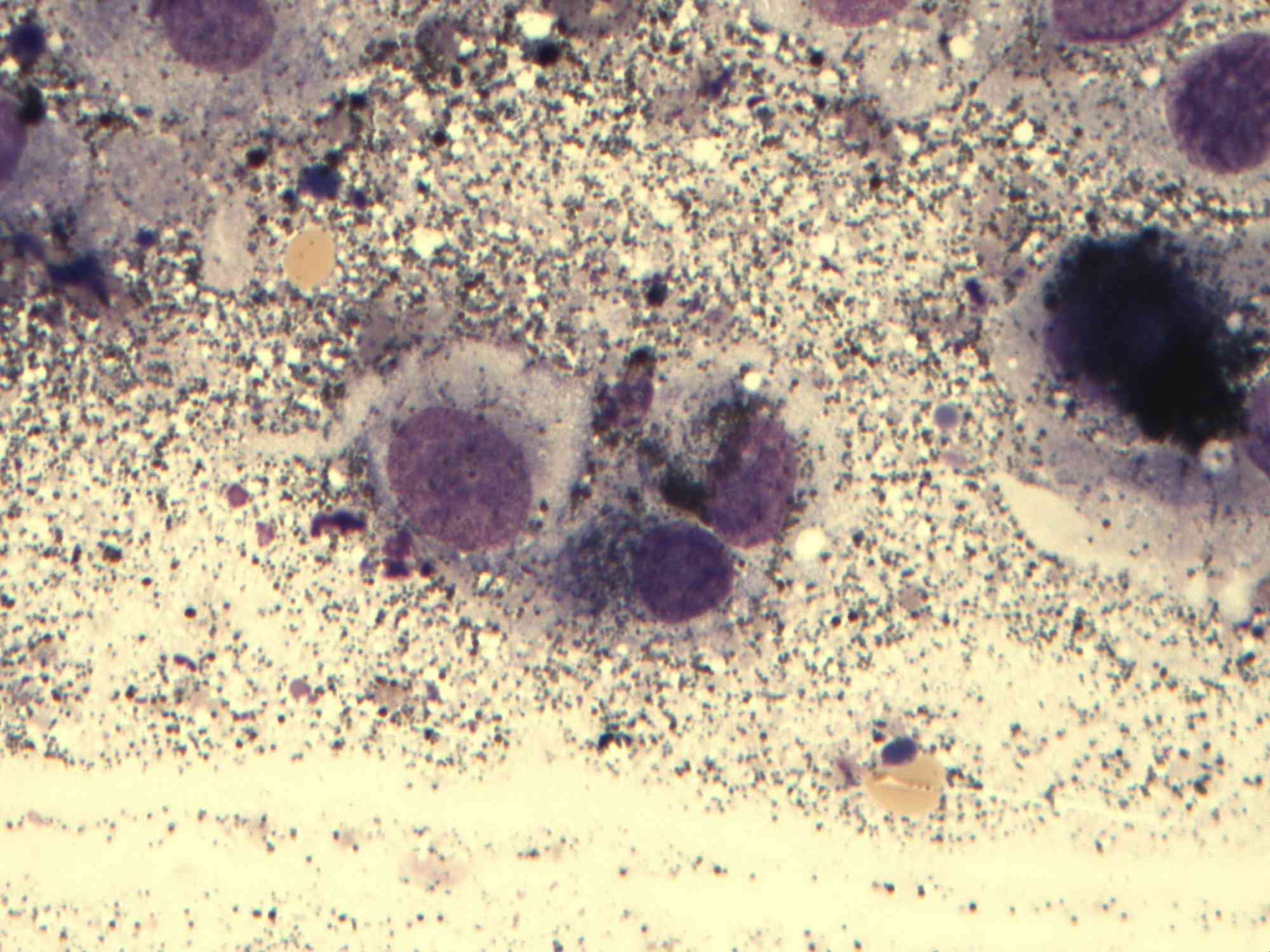 Cutaneous malignant melanoma in a rabbit Case Study Cytopath