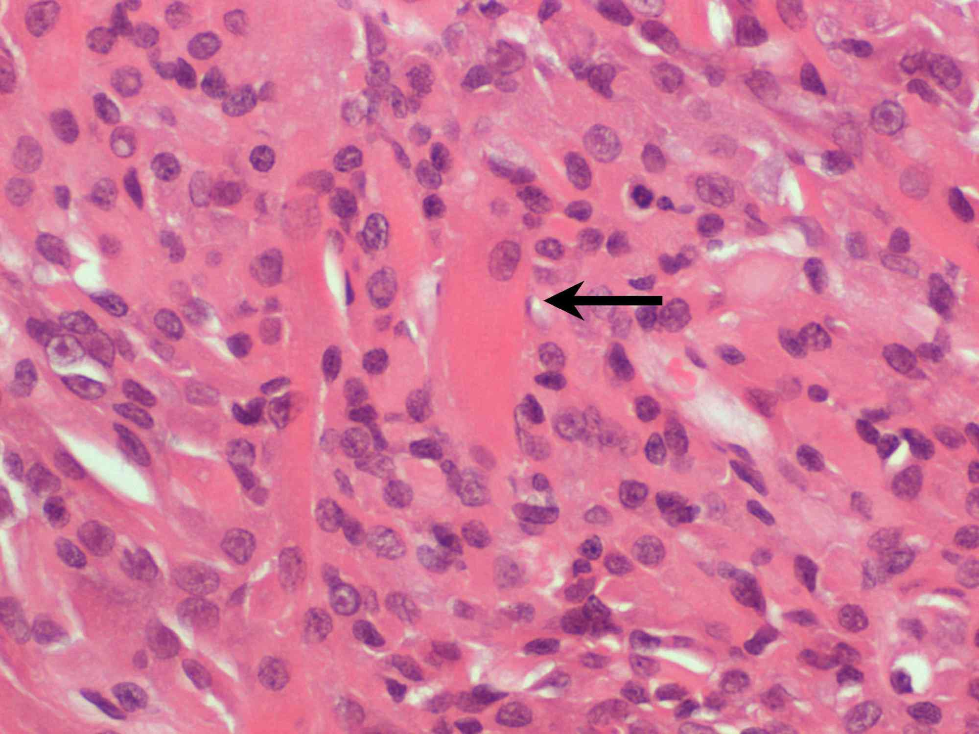 Nucleoli Present During [Startling Biological Discovery]! - bk28e91