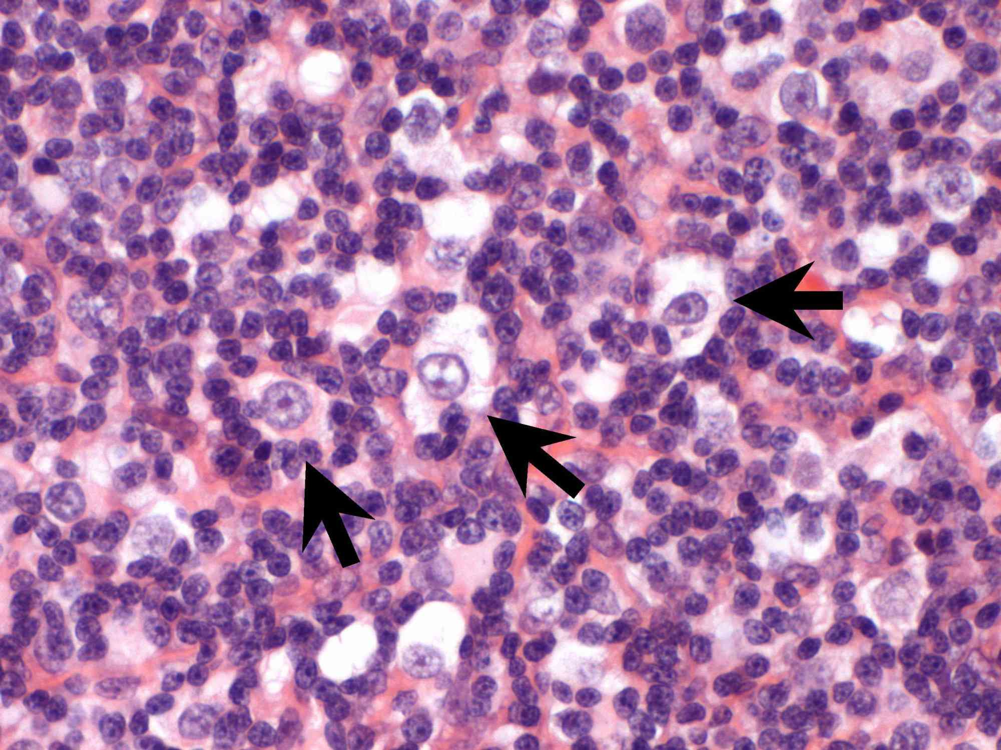 Nucleoli Present During [Startling Biological Discovery]! - bznmv5v