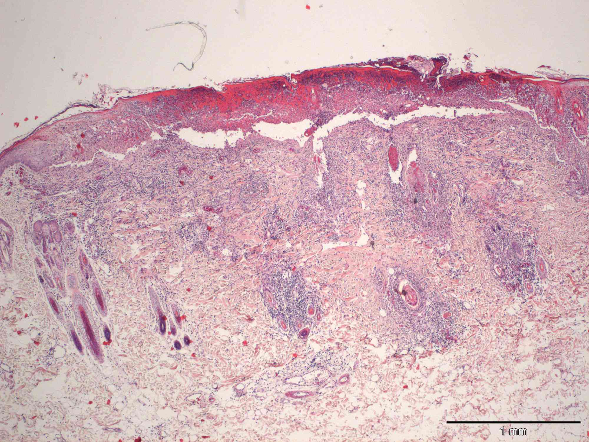 Cutaneous cowpox virus infection in a cat | Case Study | Cytopath