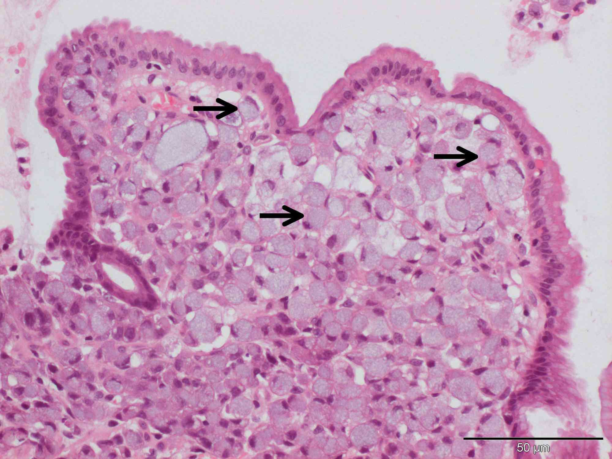Nucleoli Present During [Startling Biological Discovery]! - bewzwgr