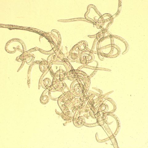 Cytology - BAL - Feline lungworm