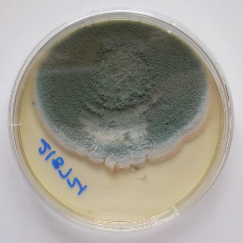 Microbiology - Fungal Culture