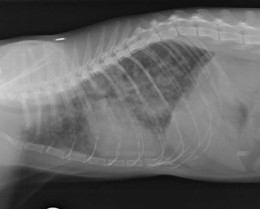 Lymphoma case study image