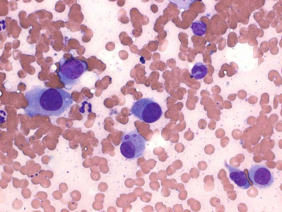 Extraskeletal in a dog Case Study Cytopath