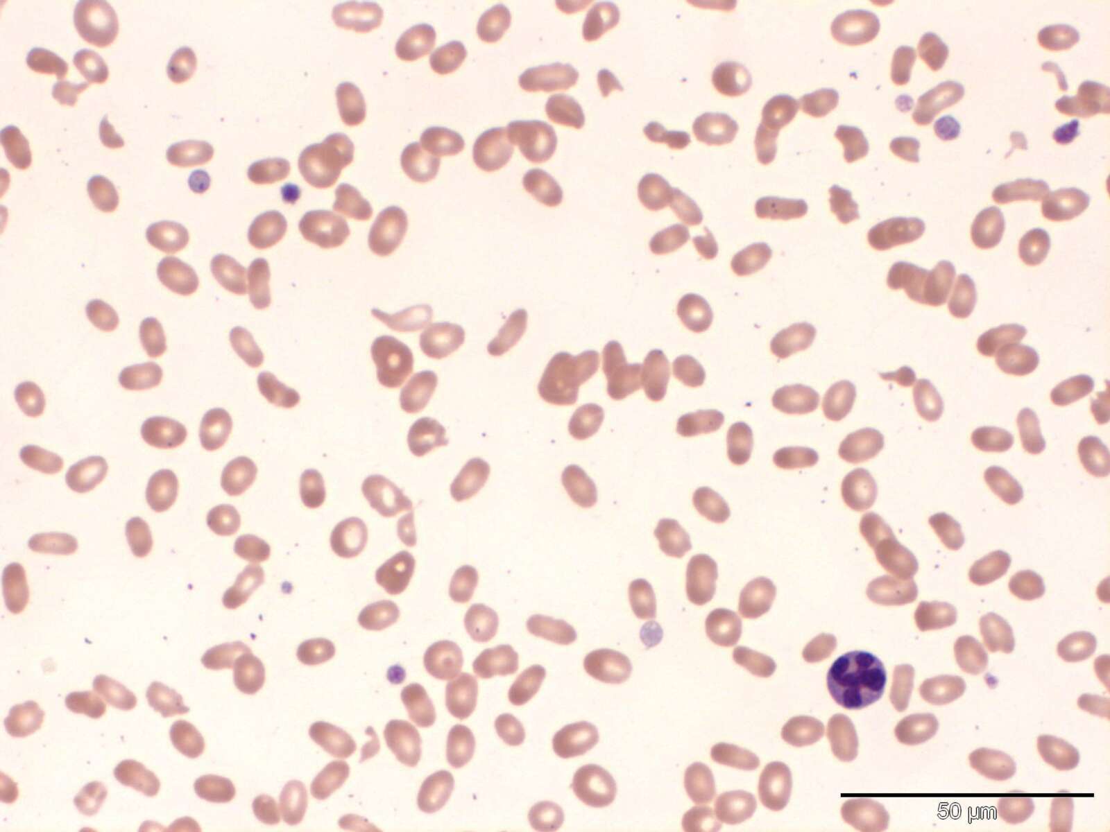 Myelofibrosis In A Dog With Non regenerative Anaem Case Study Cytopath