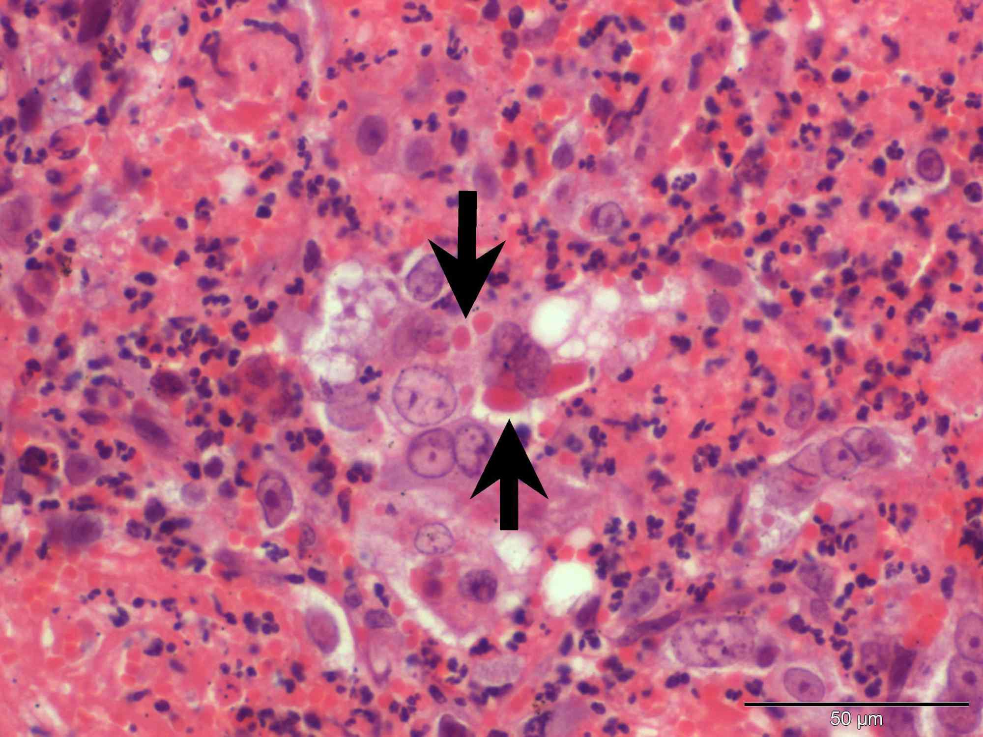 Autumn has arrived - fatal cowpox infection in a c | Case Study | Cytopath