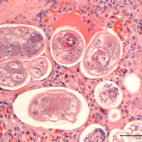 Histopathology - Feline lungworm 
