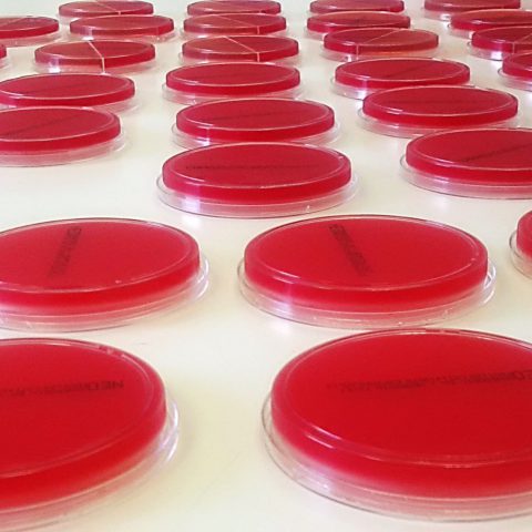 Microbiology - Blood agar plates